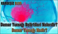 Damar Yumağı Belirtileri Nelerdir