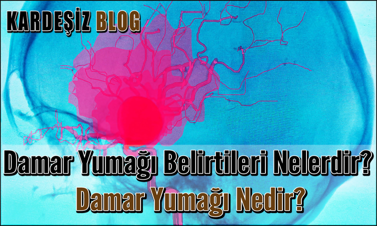 Damar Yumağı Belirtileri Nelerdir