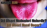 Dil Ülseri Nedenleri Nelerdir