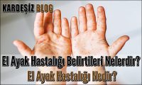 El Ayak Hastalığı Belirtileri Nelerdir