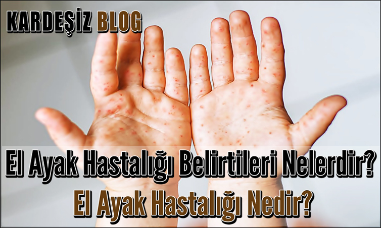 El Ayak Hastalığı Belirtileri Nelerdir