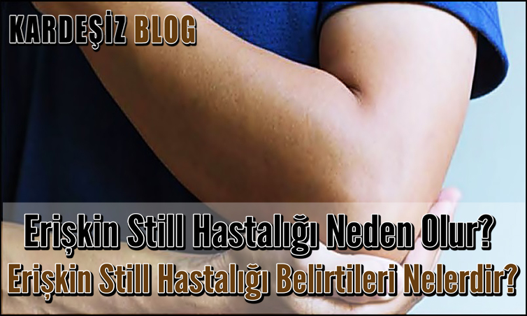 Erişkin Still Hastalığı Neden Olur