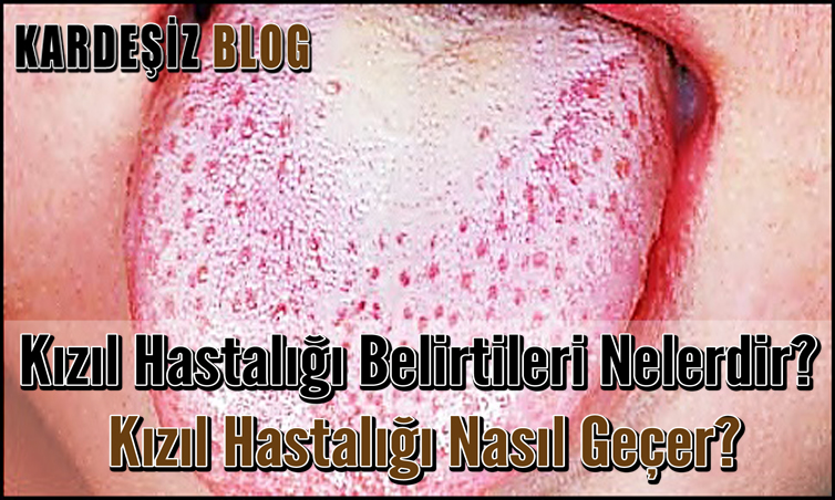 Kızıl Hastalığı Belirtileri Nelerdir