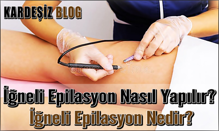 iğneli Epilasyon Nasıl Yapılır