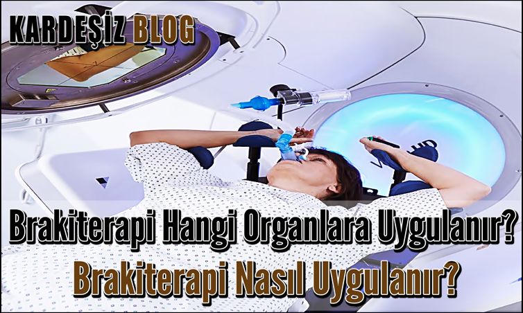 Brakiterapi Hangi Organlara Uygulanır? Brakiterapi Nasıl Uygulanır?