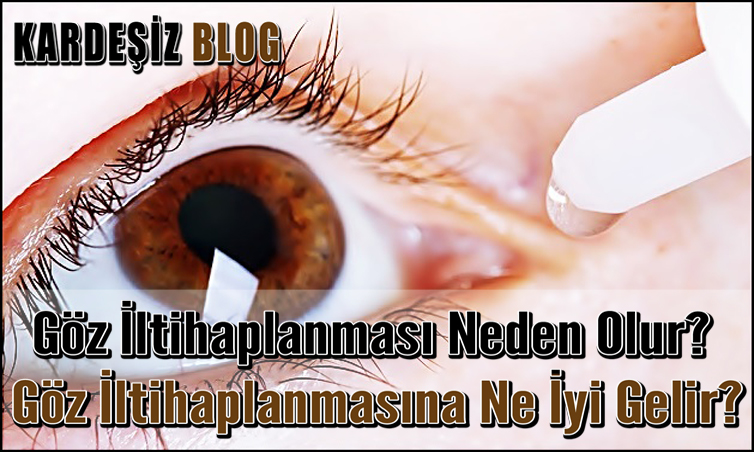 Göz iltihaplanması Neden Olur