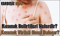 Kızamık Belirtileri Nelerdir