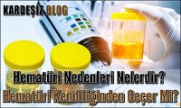 Hematüri Nedenleri Nelerdir