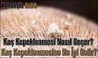 Kaş Kepeklenmesi Nasıl Geçer