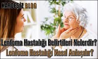 Lenfoma Hastalığı Belirtileri Nelerdir