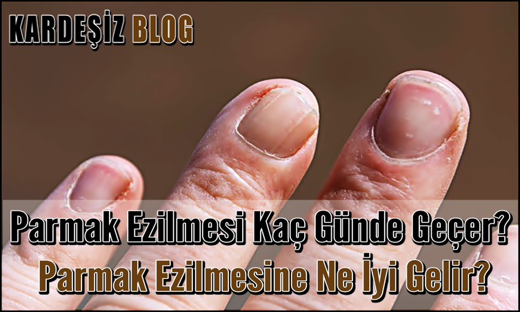 Parmak Ezilmesi Kaç Günde Geçer