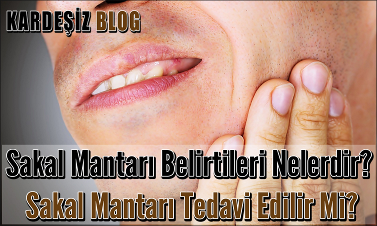 Sakal Mantarı Belirtileri Nelerdir