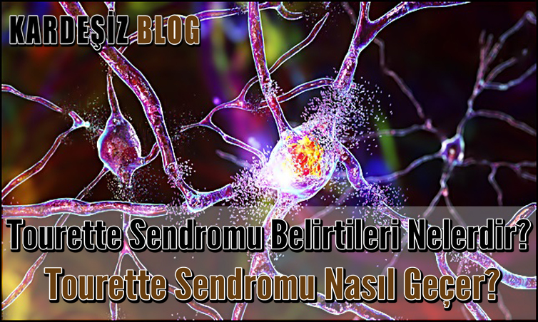 Tourette Sendromu Belirtileri Nelerdir