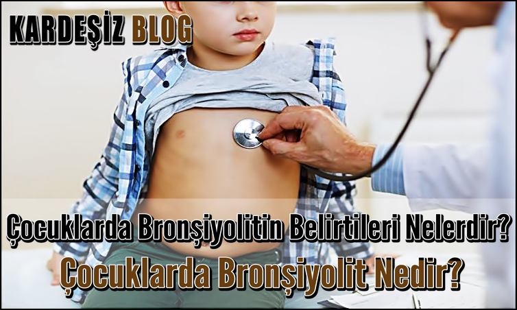 Çocuklarda Bronşiyolitin Belirtileri Nelerdir