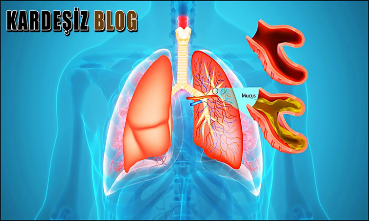 Çocuklarda Bronşiyolitin Tehlikeli Mi