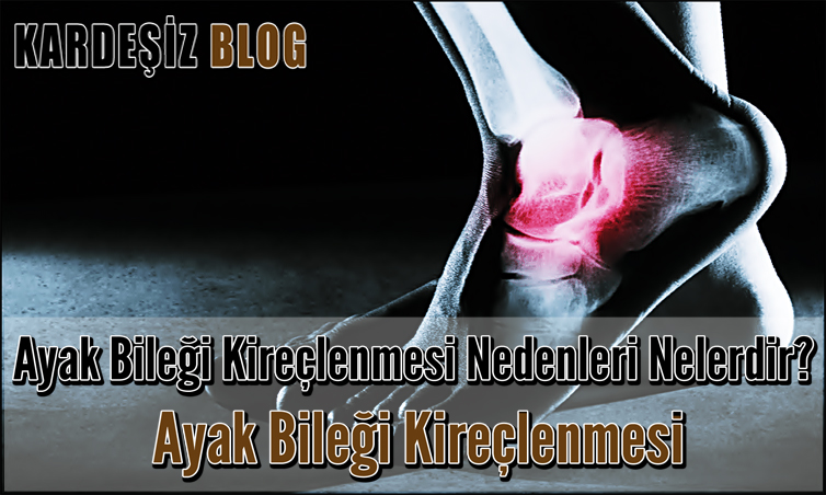Ayak Bileği Kireçlenmesi Nedenleri Nelerdir