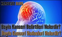 Beyin Kanseri Belirtileri Nelerdir