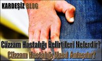 Cüzzam Hastalığı Belirtileri Nelerdir