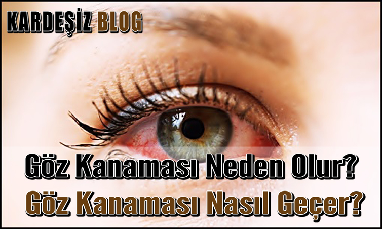 Göz Kanaması Neden Olur