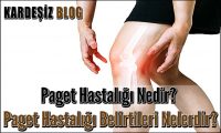 Paget Hastalığı Nedir