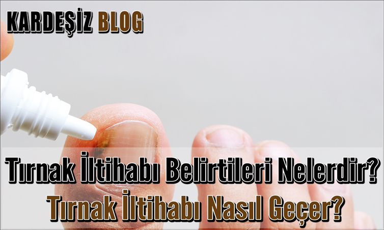 Tırnak iltihabı Belirtileri Nelerdir