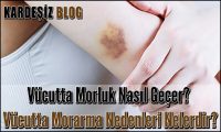 Vücutta Morluk Nasıl Geçer