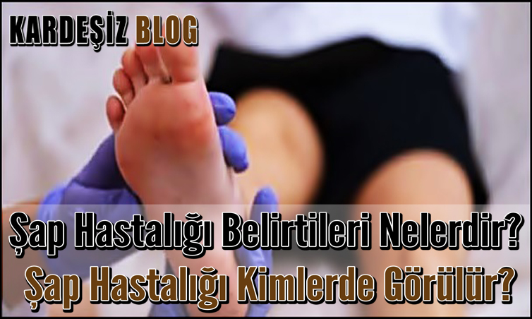 Şap Hastalığı Belirtileri Nelerdir