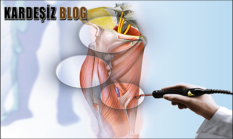 Hilterapi Acıtır Mı