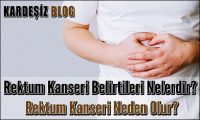 Rektum Kanseri Belirtileri Nelerdir
