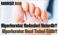 Hiperkeratoz Nedenleri Nelerdir