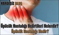 Öpücük Hastalığı Belirtileri Nelerdir