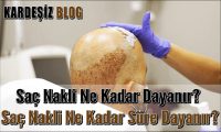 Saç Nakli Ne Kadar Dayanır