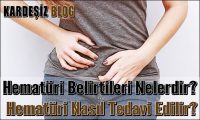 Hematüri Belirtileri Nelerdir