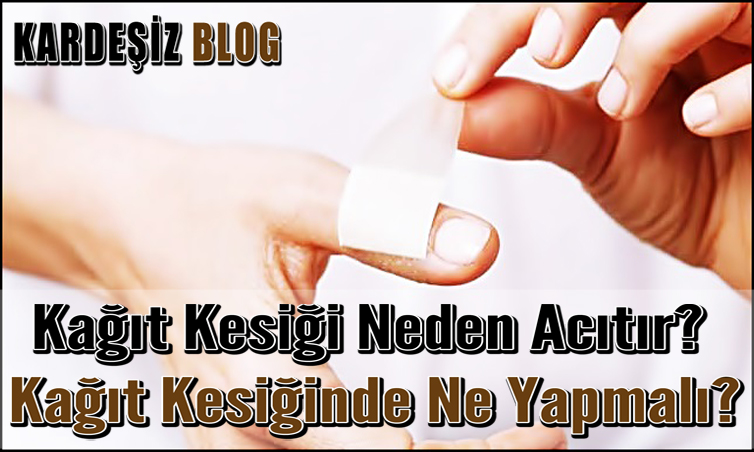 Kağıt Kesiği Neden Acıtır