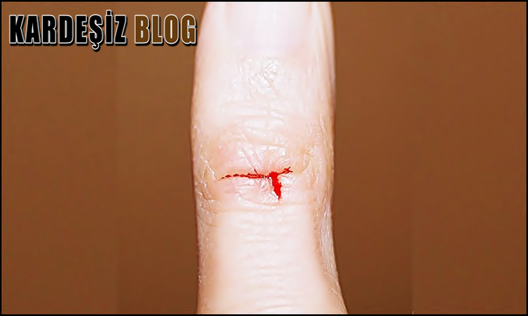 Kağıt Neden Çok Keskin