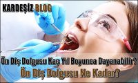 Ön Diş Dolgusu Kaç Yıl Boyunca Dayanabilir