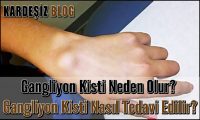 Gangliyon Kisti Neden Olur