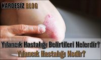 Yılancık Hastalığı Belirtileri Nelerdir