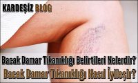 Bacak Damar Tıkanıklığı Belirtileri Nelerdir