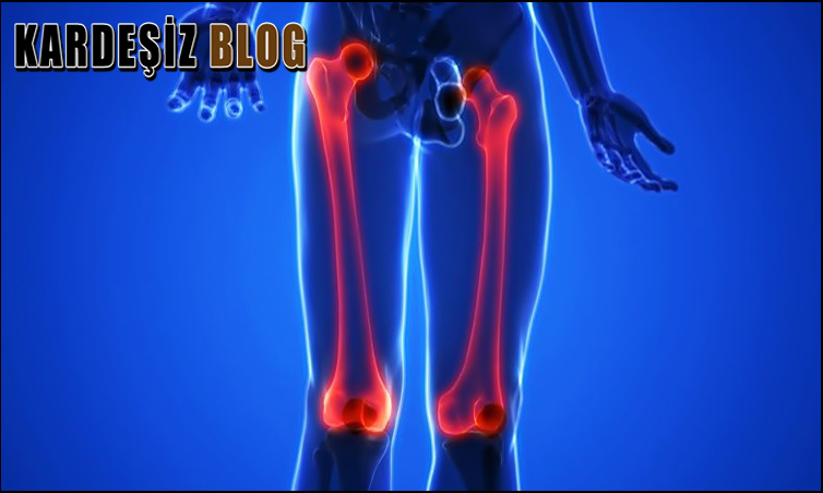 Femur Kırığı Ne Kadar Sürede Kaynar
