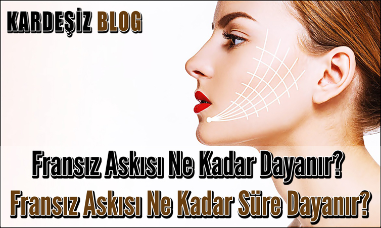 Fransız Askısı Ne Kadar Dayanır