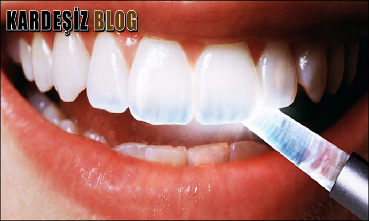 Diş Minesi Aşınması Geçer Mi