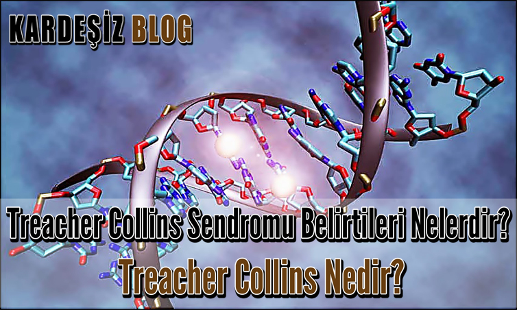 Treacher Collins Sendromu Belirtileri Nelerdir