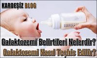 Galaktozemi Belirtileri Nelerdir