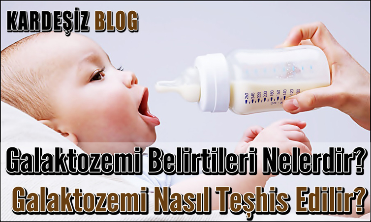 Galaktozemi Belirtileri Nelerdir