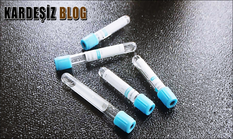 Renin Değeri Kaç Olmalı