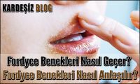 Fordyce Benekleri Nasıl Geçer