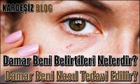 Damar Beni Belirtileri Nelerdir