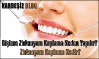 Dişlere Zirkonyum Kaplama Neden Yapılır