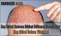 Saç Ekimi Sonrası Dikkat Edilmesi Gerekenler